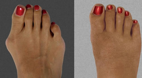 10 Crazy Beauty Treatments People Actually Pay To Do 7