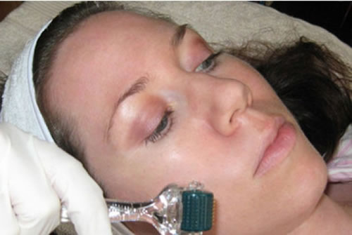 10 Crazy Beauty Treatments People Actually Pay To Do 8
