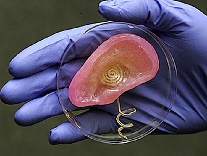 bionic ear